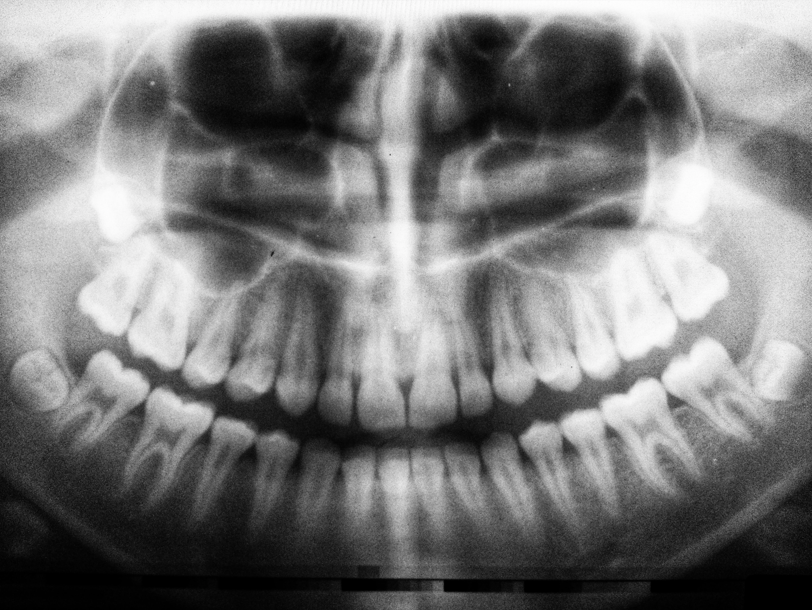 Your Teeth Are Alive!
